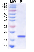 Recombinant CVA6 P2A/Protease 2A Protein, N-His