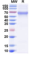 Recombinant RABV G/Glycoprotein, C-His