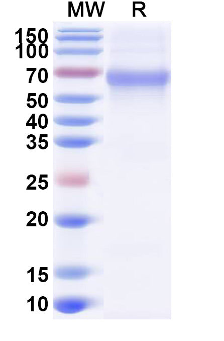 Recombinant RABV G/Glycoprotein, C-His
