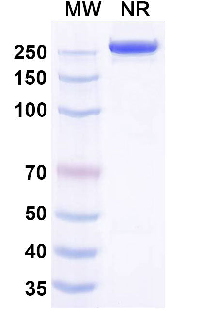 SDS-PAGE for Anti-DENV-1 Envelope protein E Antibody (14c10).