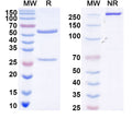 SDS-PAGE for Anti-DENV-2 Envelope protein E/EDIII LR C-C' loop Antibody (E87#)