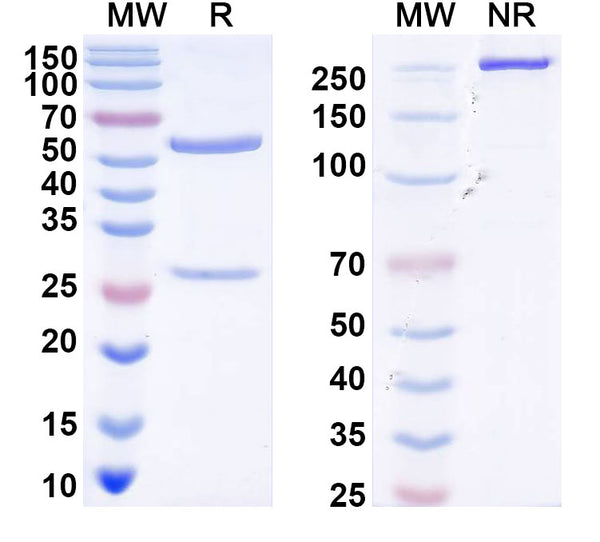 SDS-PAGE for Anti-DENV-2 Envelope protein E/EDI/II dimer interface Antibody (E44#)