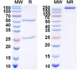 SDS-PAGE for Anti-DENV-2 Envelope protein E/EDII fusion loop Antibody (E60#)