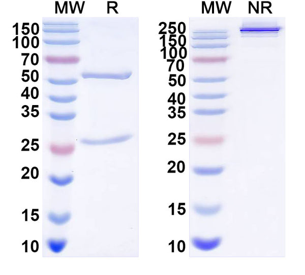 SDS-PAGE for Anti-DENV-2 Envelope protein E/EDII fusion loop Antibody (E60#)
