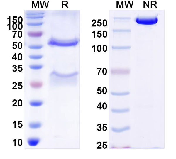 SDS-PAGE for Anti-DENV-2 Envelope protein E/EDE2 Antibody (B7)