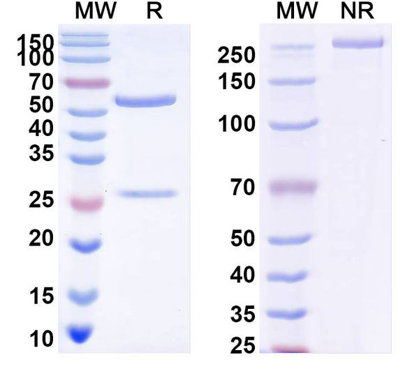 SDS-PAGE for Anti-DENV-4 Envelope protein E/EDIII domain Antibody (scFv513)