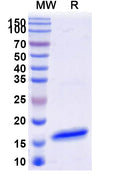 SDS-PAGE for Anti-SARS-CoV S/Spike glycoprotein Nanobody (SAA1322)