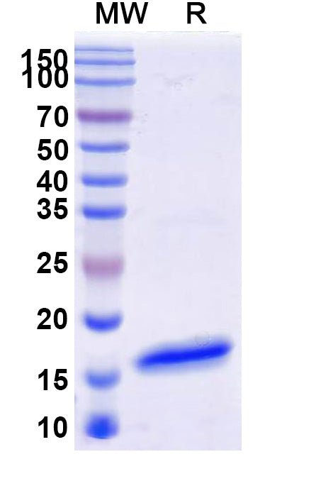 SDS-PAGE for Anti-SARS-CoV S/Spike glycoprotein Nanobody (SAA1322)