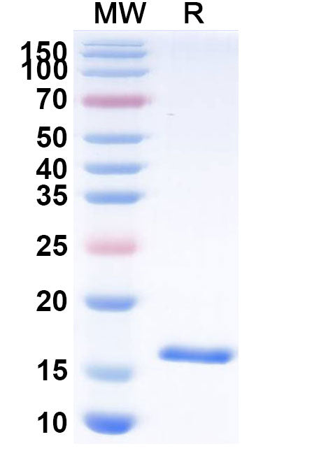 SDS-PAGE for Anti-HCMV/HHV5 HHRF3/US28 Nanobody (SAA1150).