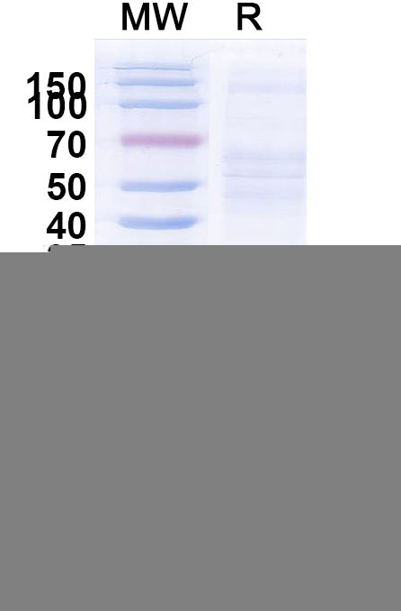 SDS-PAGE for Anti-HCMV/HHV5 HHRF3/US28 Nanobody (SAA1107)