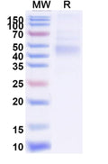Recombinant EBV/HHV-4 gH/BXLF2 Protein, C-His