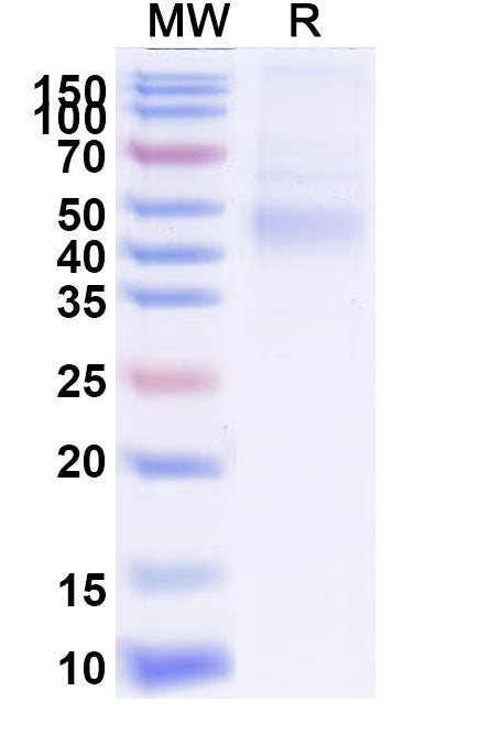 Recombinant EBV/HHV-4 gH/BXLF2 Protein, C-His