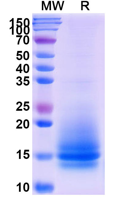 Recombinant Monkeypox virus/MPXV A35R Protein, C-His