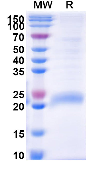 Recombinant Monkeypox virus/MPXV D14L Protein, C-His