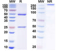 SDS-PAGE for Anti-Canine Parvovirus/CPV Monoclonal Antibody (1A420)