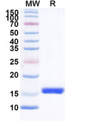 SDS-PAGE for Anti-HIV1 Surface protein gp120 Nanobody (SAA0912)