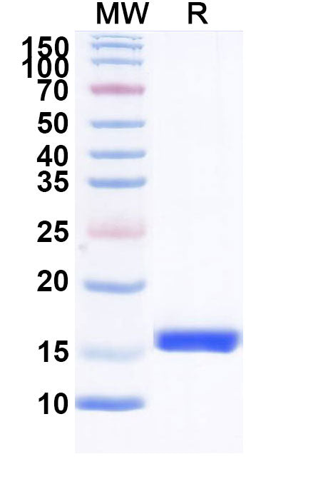 SDS-PAGE for Anti-HIV1 Surface protein gp120 Nanobody (SAA0912)