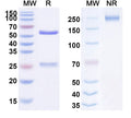 Anti-HIV-1 gp120 Reference Antibody (Suvizumab) – Figure 1 of 2