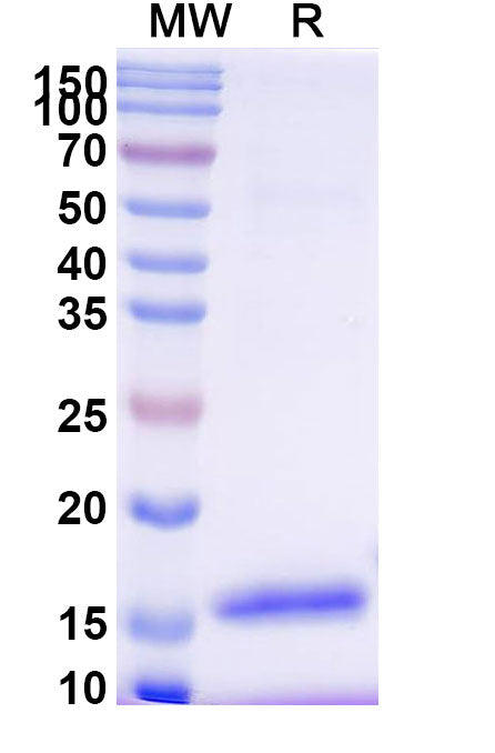 SDS-PAGE for Anti-HIV1 Surface protein gp120 Nanobody (SAA0881)