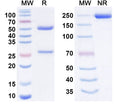 Anti-HIV-1 gp120 Reference Antibody (Elipovimab) – Figure 1 of 1