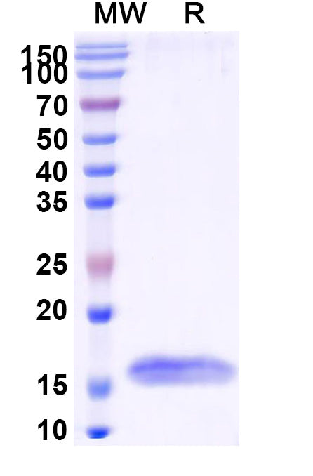 SDS-PAGE for Anti-HIV1 Surface protein gp120 Nanobody (SAA0882)