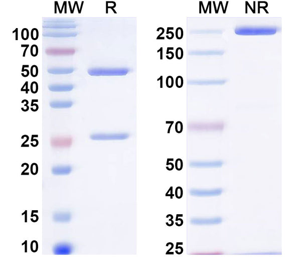 SDS-PAGE for InVivoMAb Anti-HIV1 env/Env polyprotein Antibody (Iv0116)