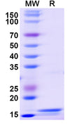 Recombinant Monkeypox virus/MPXV L1R Protein, N-His