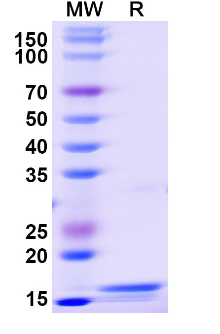 Recombinant Monkeypox virus/MPXV L1R Protein, N-His