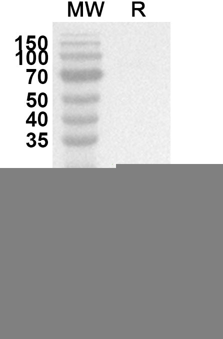 Western blot analysis was performed using anti-Monkeypox virus/MPXV L1R polyclonal antibody at 1ug/mL on recombinant Monkeypox virus/MPXV L1R (Catalog No. VK618012).
