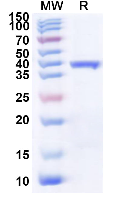 Recombinant Avian HEV Capsid Protein, N-His