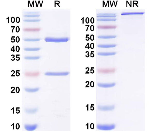 SDS-PAGE for Anti-Hepatitis E virus/HEV pORF2 P domain Neutralizing Antibody (SAA2239)