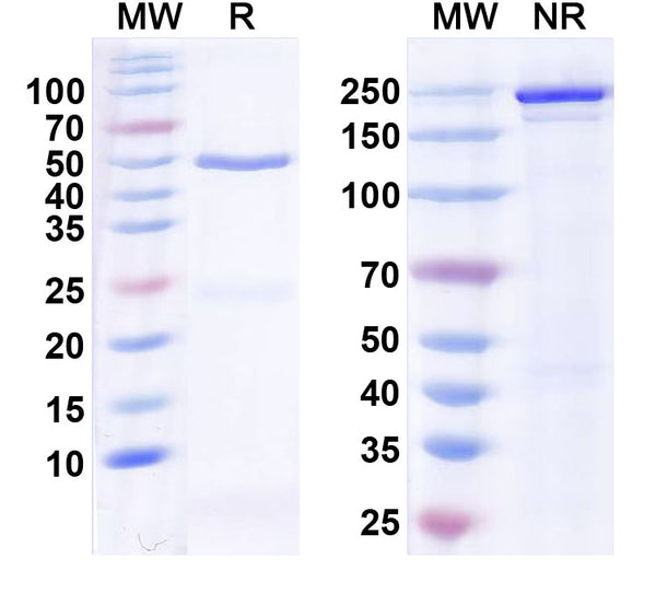 SDS-PAGE for Anti-Hepatitis E virus/HEV pORF2 P domain Neutralizing Antibody (SAA2240)
