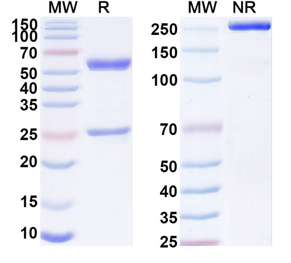 SDS-PAGE for Anti-Hepatitis E virus/HEV E2s domain Antibody (8C11)