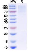 Recombinant EBV/HHV4 BLLF1/MA/GP350 Protein, C-His