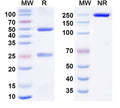 Anti-Ebolavirus GP/Glycoprotein Reference Antibody (Larcaviximab) – Figure 1 of 1