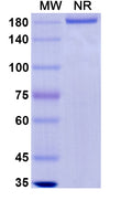 Anti-Ebolavirus GP/Glycoprotein Reference Antibody (Odesivimab) – Figure 1 of 1