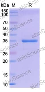 SDS-PAGE for T5 Exonuclease
