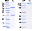 Anti-RABV Glycoprotein G Reference Antibody (Zamerovimab) – Figure 1 of 1