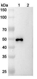 Anti-RABV glycoprotein G Reference Antibody (Rafivirumab) – Figure 1 of 1