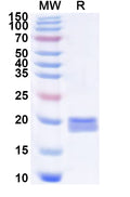 Recombinant EV71 P2A/Protease 2A Protein, N-His