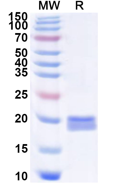 Recombinant EV71 P2A/Protease 2A Protein, N-His