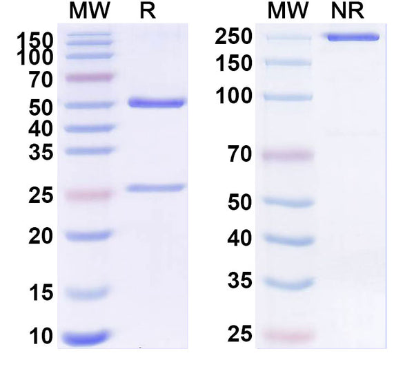 SDS-PAGE for Anti-EV71 VP1/Capsid protein VP1 Antibody (MA28-7)