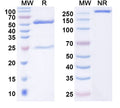 SDS-PAGE for Anti-EV71 Capsid protein VP1/2/3 Antibody (SAA2027).