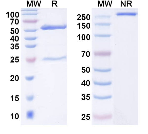 SDS-PAGE for Anti-EV71 Capsid protein VP1/2/3 Antibody (SAA2027).