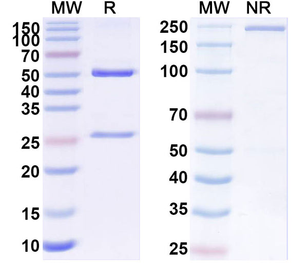 SDS-PAGE for Anti-EV71 Capsid protein VP1/2/3 Antibody (SAA2028)