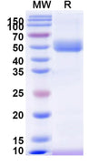 Recombinant WEEV Spike glycoprotein E1 Protein, C-His