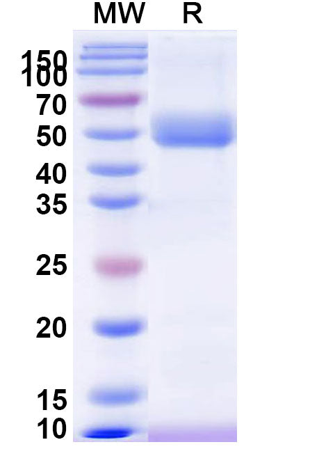Recombinant WEEV Spike glycoprotein E1 Protein, C-His