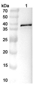 Western blot analysis was performed using anti-EEEV-E2 polyclonal antibody at 1ug/mL on various samples.
Lane 1: recombinant EEEV Spike glycoprotein E2 (Catalog No: VK634012)