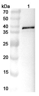 Western blot analysis was performed using anti-EEEV-E2 polyclonal antibody at 1ug/mL on various samples.
Lane 1: recombinant EEEV Spike glycoprotein E2 (Catalog No: VK634012)