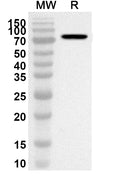 Western blot analysis was performed using anti-HPV18 L1/Major capsid protein L1 polyclonal antibody at 1ug/mL on recombinant HPV18 L1/Major capsid protein L1 (Catalog No. VK639012).